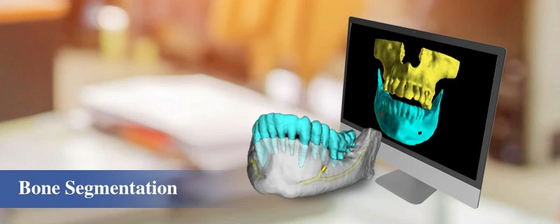 bone segmentation