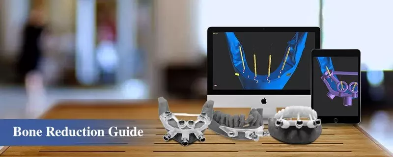 bone segmentation